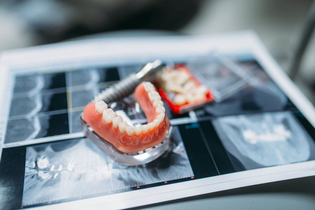 dentures