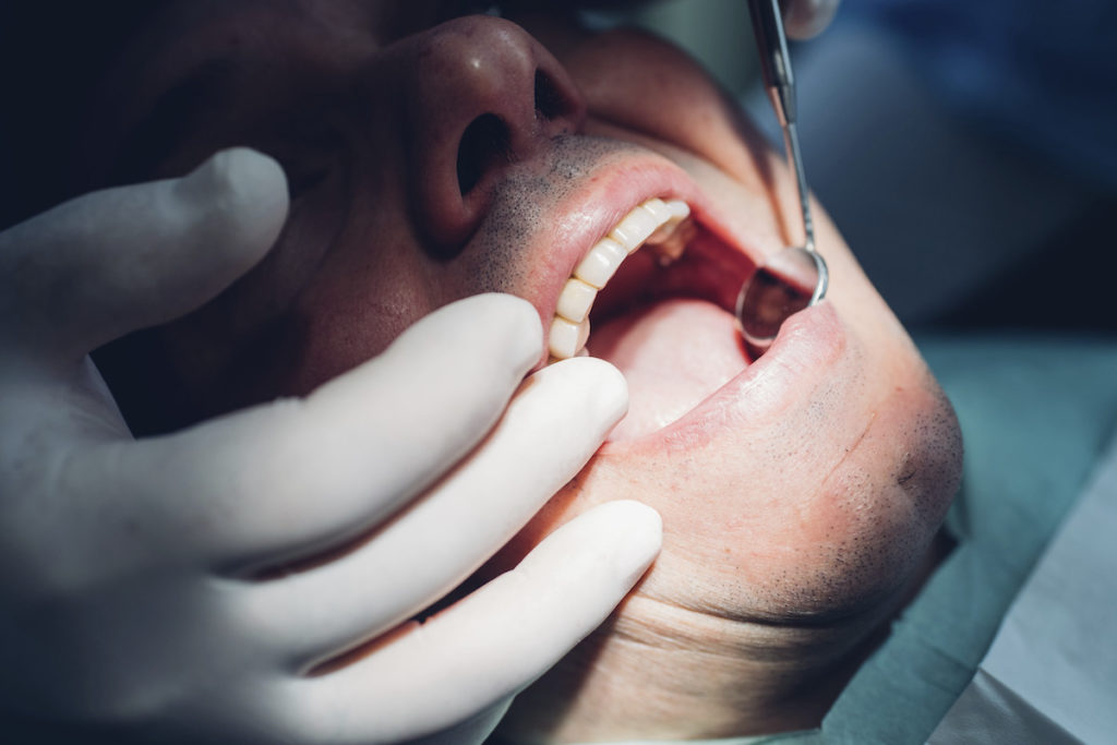 Dentist performing a dental procedure on a male patient for periodontal disease treatment, close-up view.