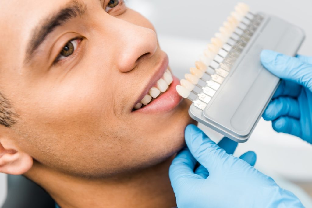 Dental professional using a shade guide to determine a patient's current tooth colour before addressing the Causes of Tooth Discolouration.